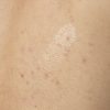 Salicylic Acid 0.5% Body Serum